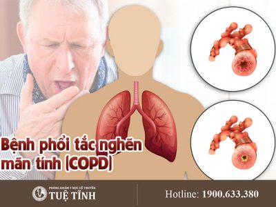COPD-0