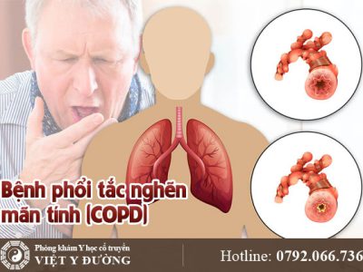 COPD-0