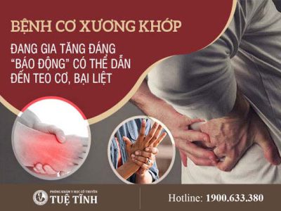 benh-co-xuong-khop