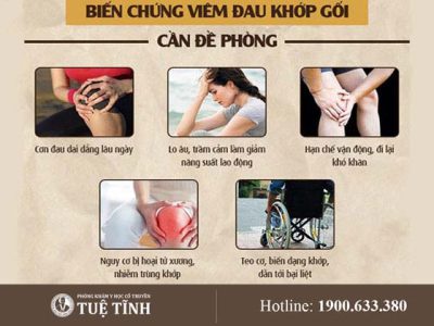 bien-chung-dau-khop-goi