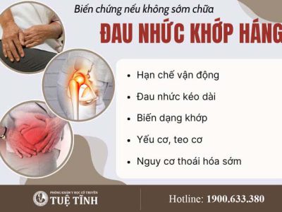 bien-chung-dau-khop-hang