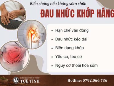 bien-chung-dau-khop-hang