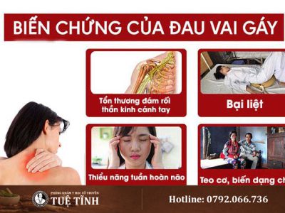 bien-chung-dau-vai-gay