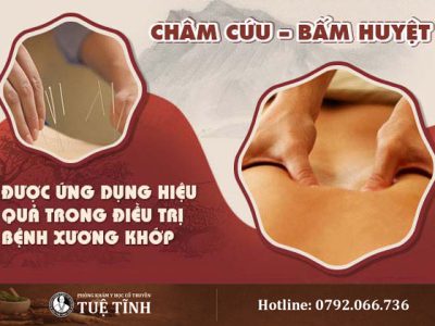 cham-cuu-bam-huyet