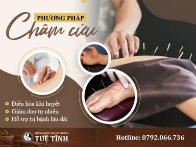 cham-cuu-dieu-hoa-khi-huyet-giam-dau-tu-nhien-ho-tro-tri-benh-lau-dai