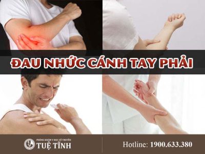 dau-nhuc-canh-tay-phai