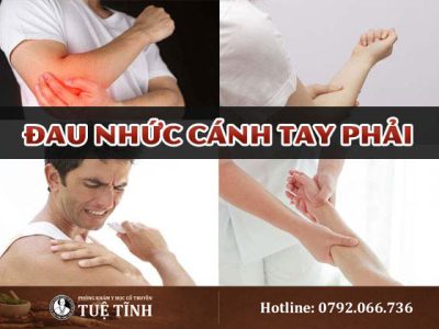 dau-nhuc-canh-tay-phai