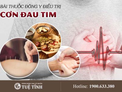 dieu-tri-con-dau-tim