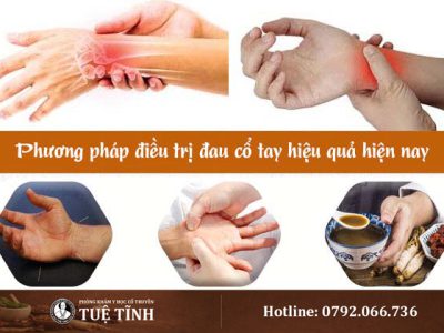 dieu-tri-dau-co-tay-yhct