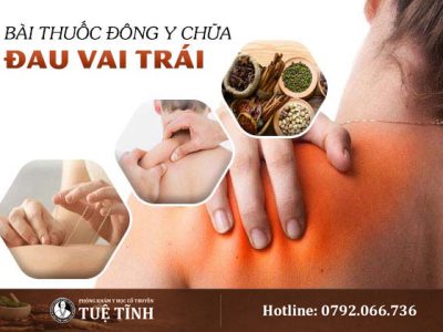 dieu-tri-dau-vai-trai-yhct