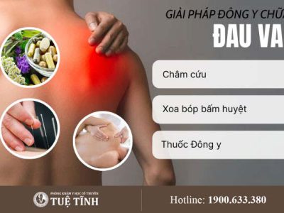 dieu-tri-dau-vai-yhct