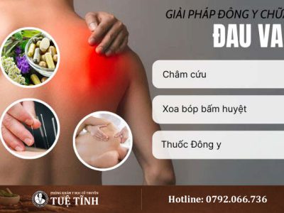 dieu-tri-dau-vai-yhct
