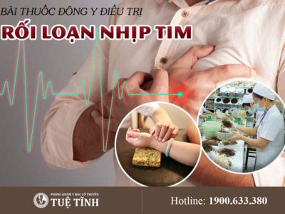 dieu-tri-roi-loan-nhip-tim