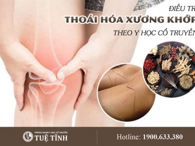 dieu-tri-thoai-hoa-khop