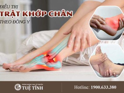 dieu-tri-trat-khop-chan