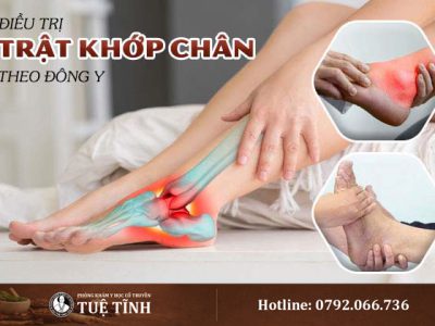 dieu-tri-trat-khop-chan