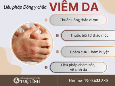 dieu-tri-viem-da