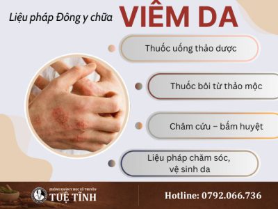 dieu-tri-viem-da