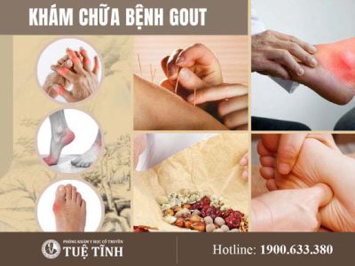 kham-chua-benh-gout