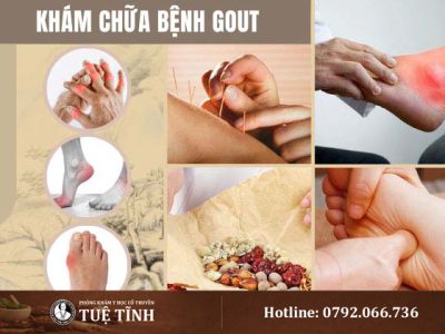 kham-chua-benh-gout
