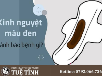 kinh nguyệt (1)