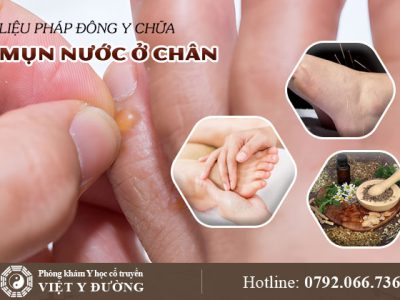 mun-nuoc-o-chan-dieu-tri