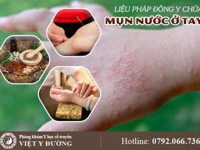 mun-nuoc-o-tay