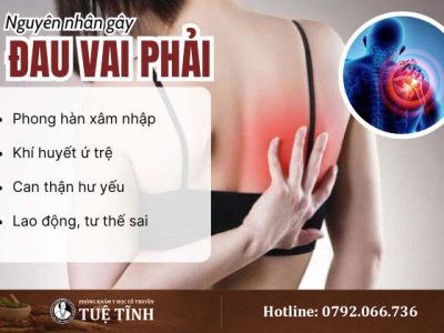 nguyen-nhan-dau-vai-phai