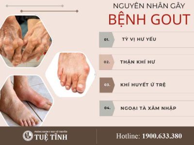 nguyen-nhan-gay-benh-gout