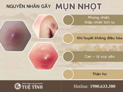 nguyen-nhan-mun-nhot