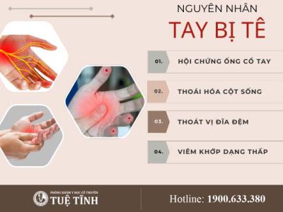 nguyen-nhan-tay-bi-te