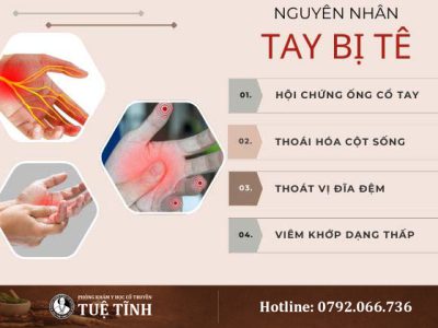 nguyen-nhan-tay-bi-te