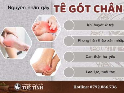 nguyen-nhan-te-got-chan