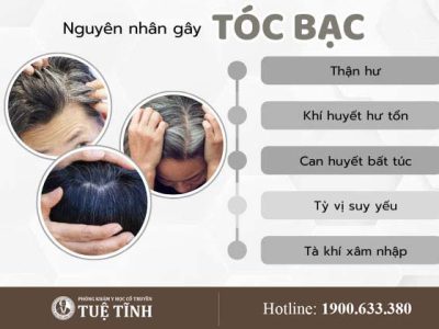 nguyen-nhan-toc-bac
