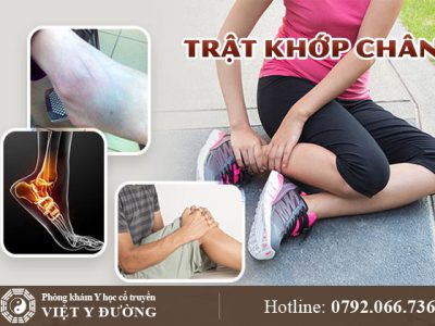 trat-khop-chan-0