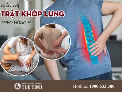 trat-khop-lung-0