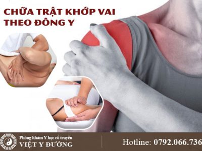 trat-khop-vai-dieu-tri