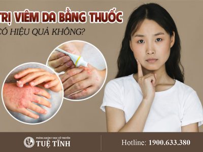 tri-viem-da-bang-thuoc