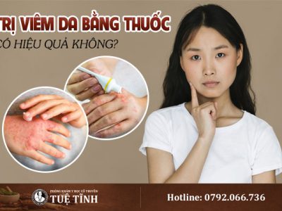 tri-viem-da-bang-thuoc