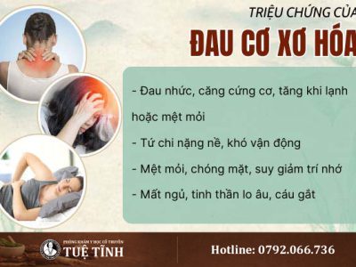 trieu-chung-dau-co-xo-hoa
