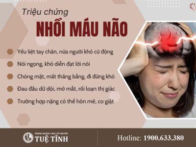trieu-chung-nhoi-mau-nao