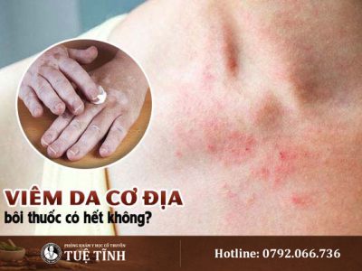 viem-da-co-dia-boi-thuoc