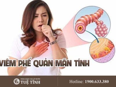 viem-phe-quan-man-tinh